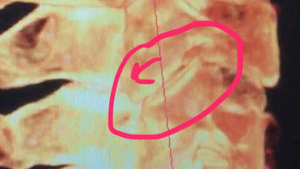 BLAIR PROTRACTO VIEW ON RIGHT