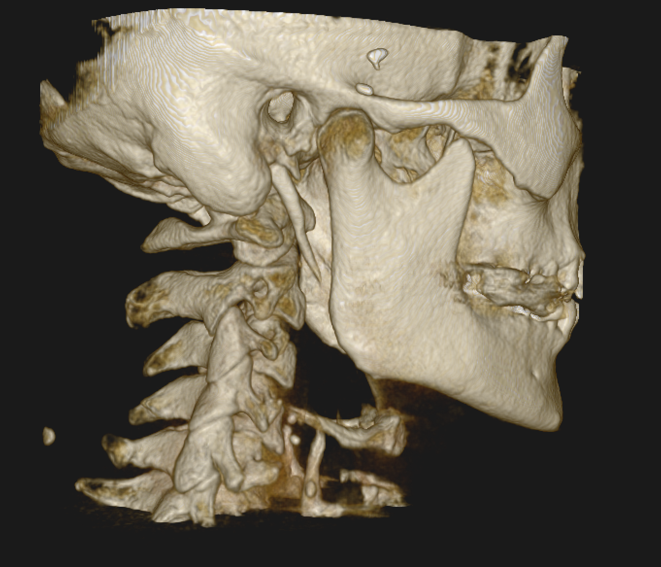 Vertigo Specialist in Sarasota