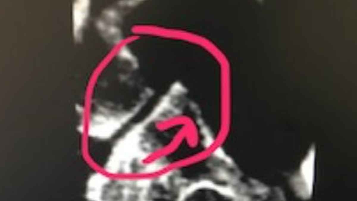 BLAIR PROTRACTO VIEW ON RIGHT BW