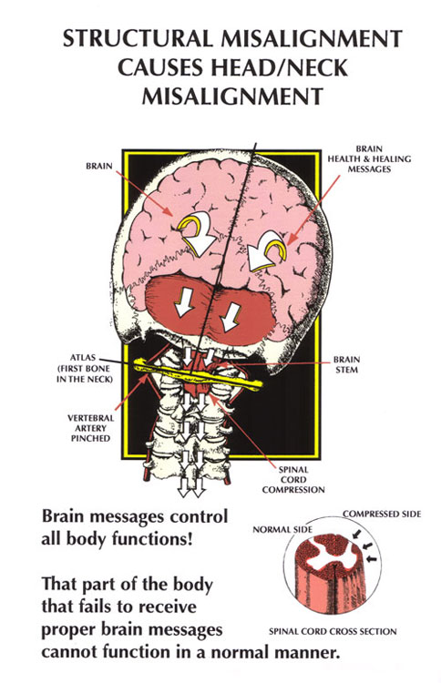 Somatic Tinnitus: When Jaw and Neck Movements Change Your Ear Ringing